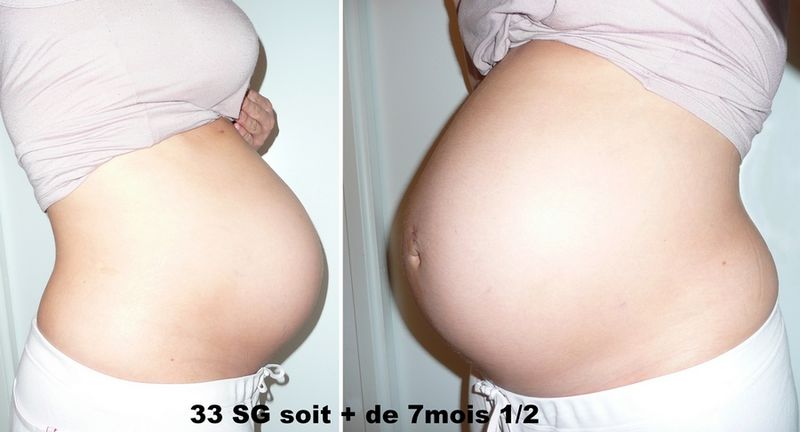 La raison du développement osteokhondroza