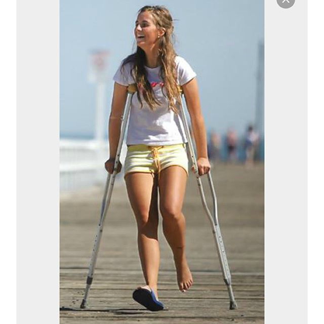  Sprained ankle, crutches and footbare