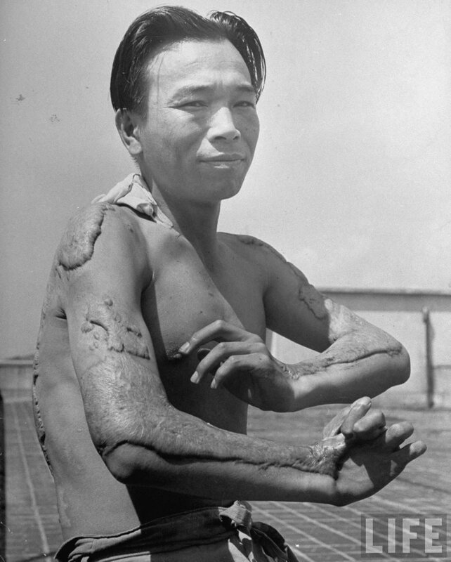hist_us_20_ww2_hiroshima_pic_japan_hiroshima_survivor_ayg1947
